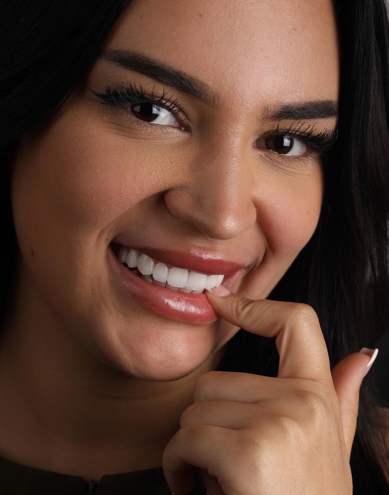 Pacienti buzëqesh pas trajtimit estetik dentar në studio